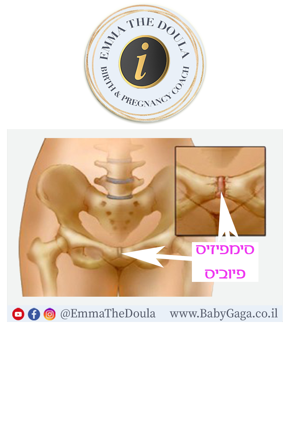 סימפיזיוליזיס? יש מה לעשות! הקלה,טיפול ואימוץ שגרת יום יום מותאמת הריון.